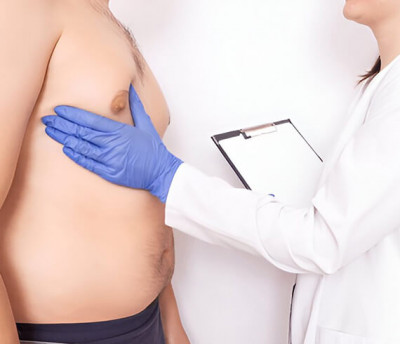 Gynecomastia Surgery in Delhi by Dr. Lokesh Handa: 