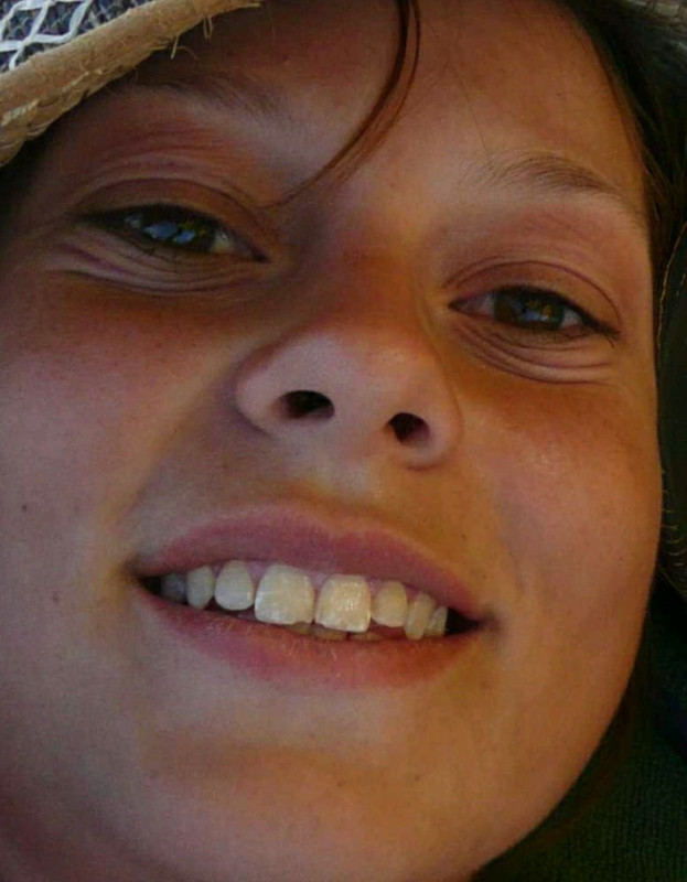 Aline Face